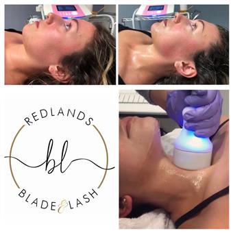 Redlands Cryoslim In Redlands CA Vagaro